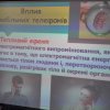 Вплив мобільного телефону на здоров’я молоді